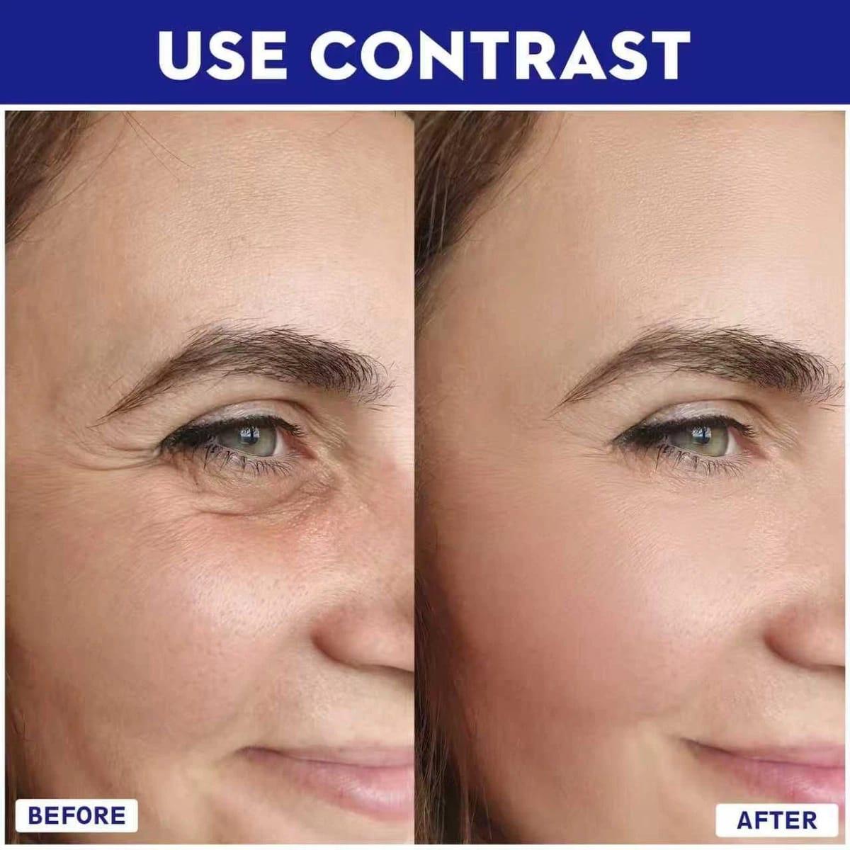 Thabet & Kin Anti-Aging Solution Microneedle Infusion Kit