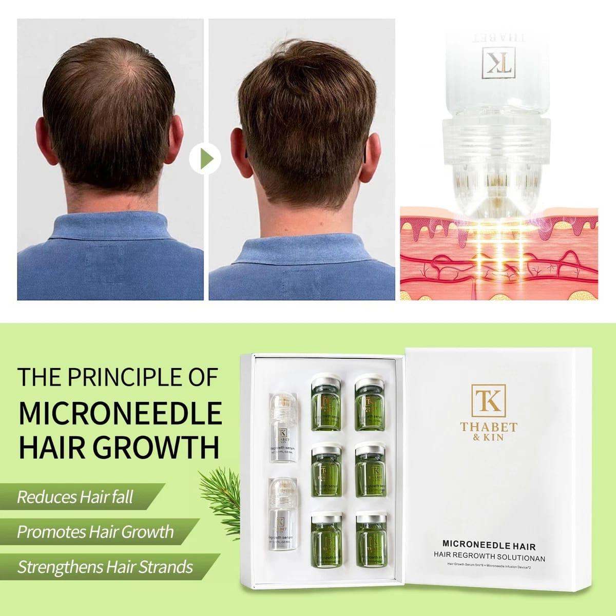 Thabet & Kin Hair Growth Micro infusion Kit