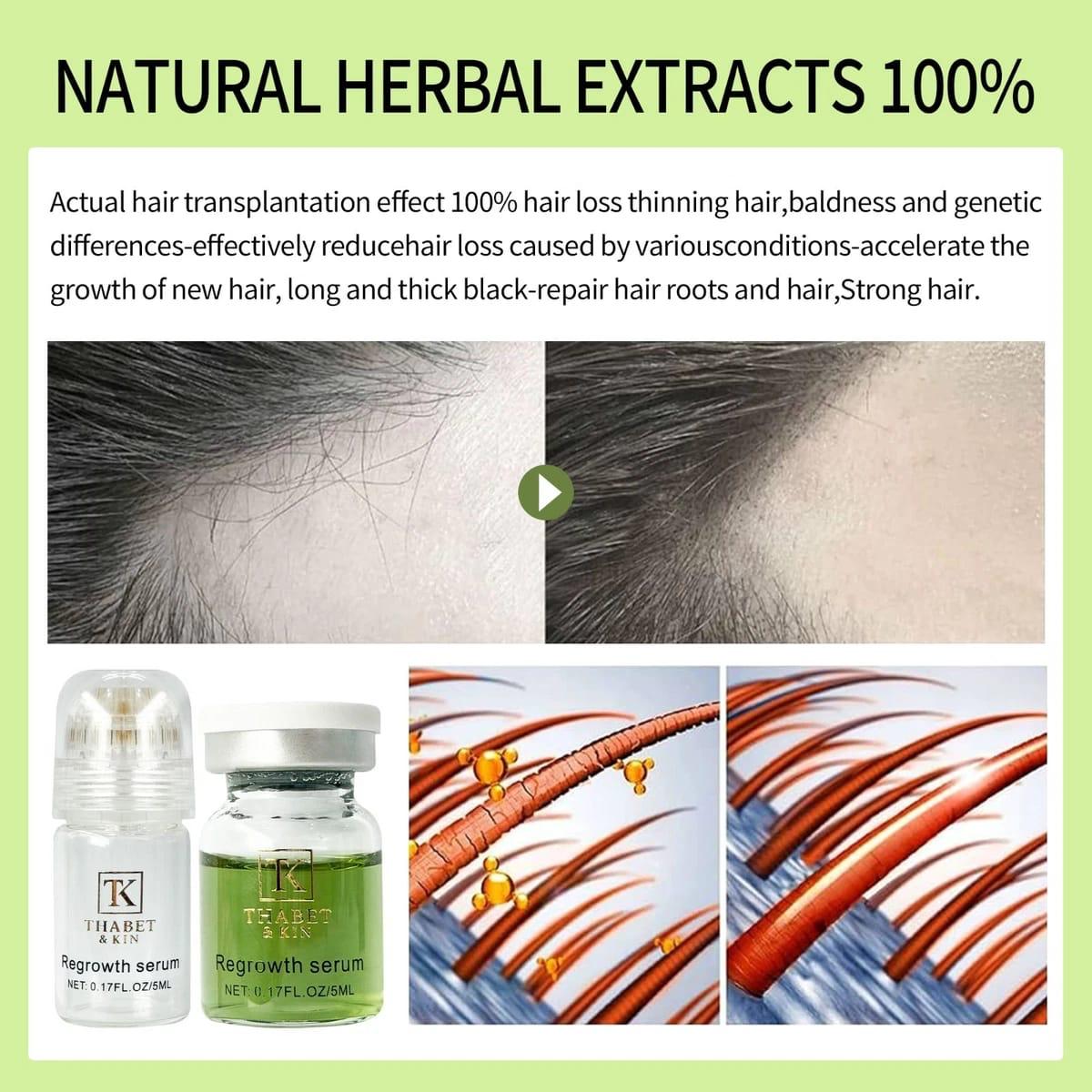 Thabet & Kin Hair Growth Micro infusion Kit