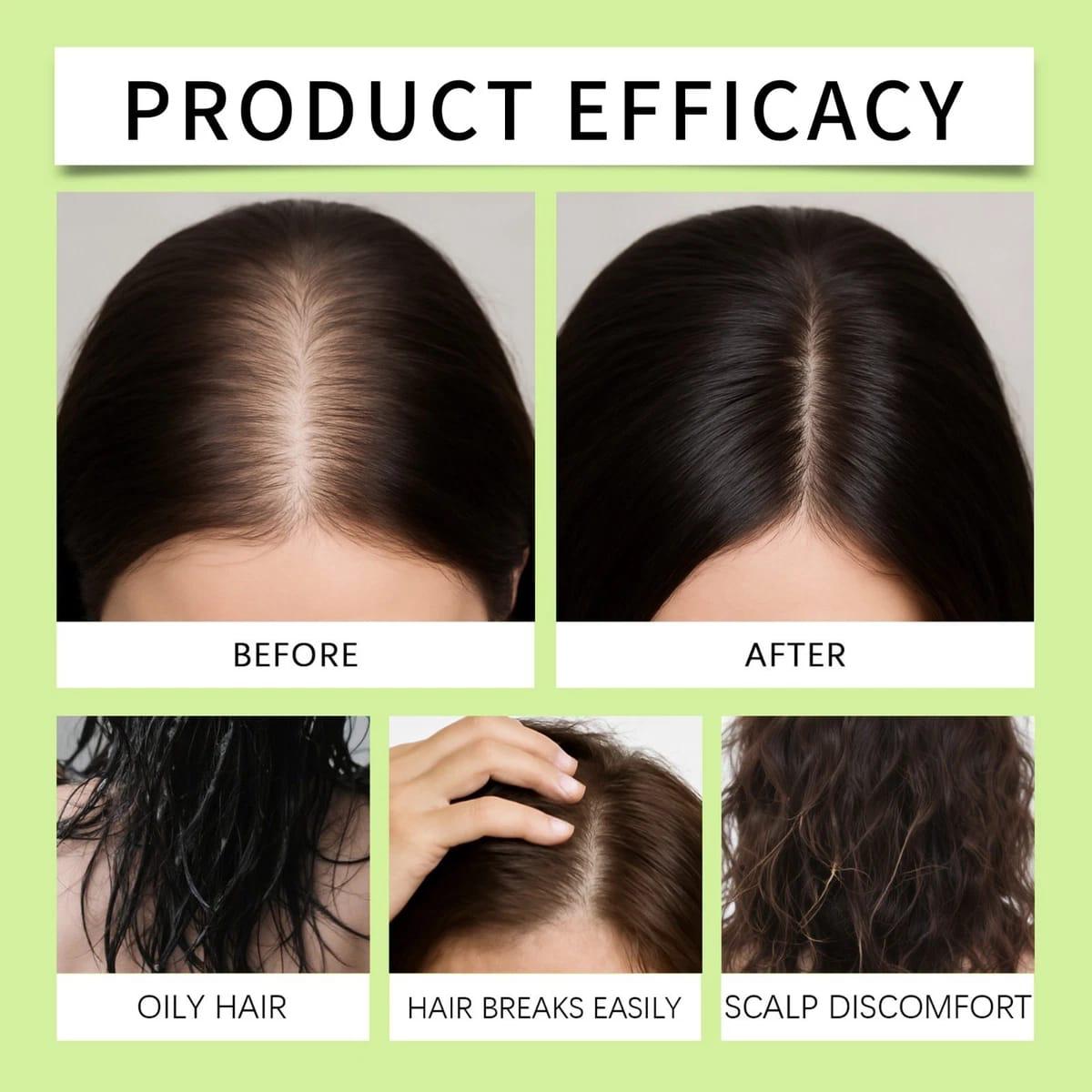 Thabet & Kin Hair Growth Micro infusion Kit